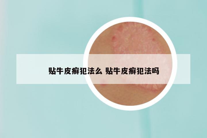 贴牛皮癣犯法么 贴牛皮癣犯法吗