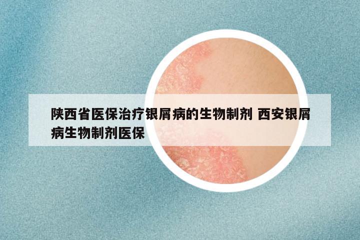 陕西省医保治疗银屑病的生物制剂 西安银屑病生物制剂医保