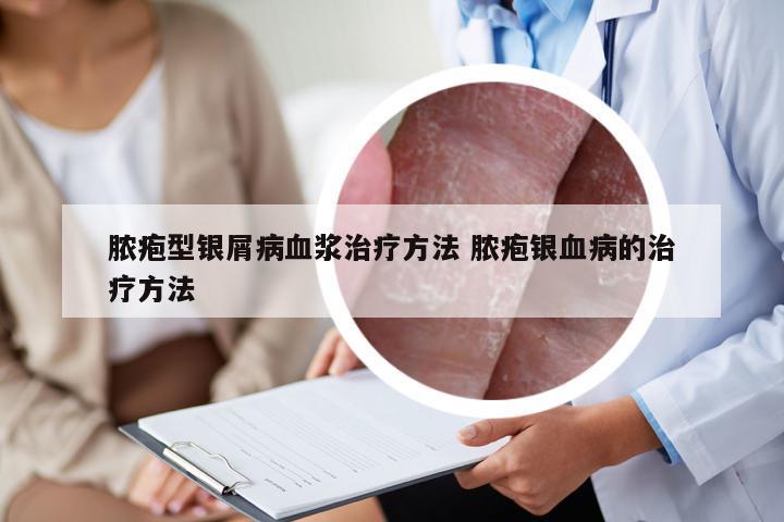 脓疱型银屑病血浆治疗方法 脓疱银血病的治疗方法