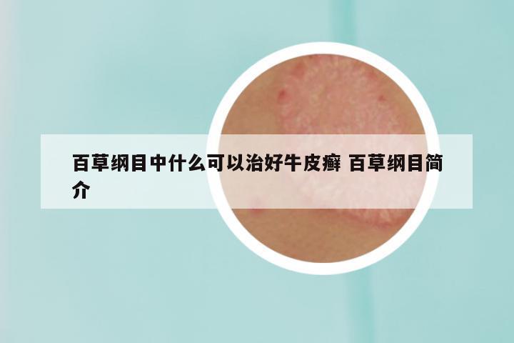 百草纲目中什么可以治好牛皮癣 百草纲目简介
