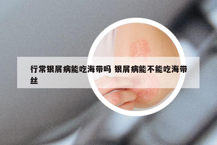 行常银屑病能吃海带吗 银屑病能不能吃海带丝