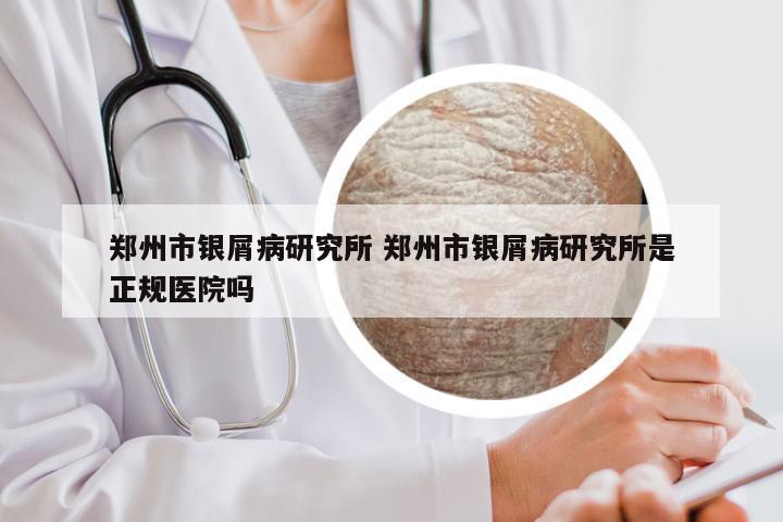 郑州市银屑病研究所 郑州市银屑病研究所是正规医院吗