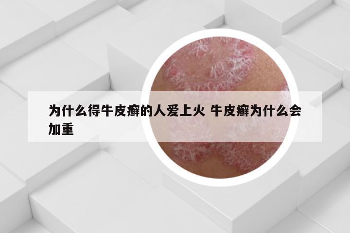 为什么得牛皮癣的人爱上火 牛皮癣为什么会加重