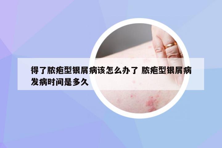 得了脓疱型银屑病该怎么办了 脓疱型银屑病发病时间是多久