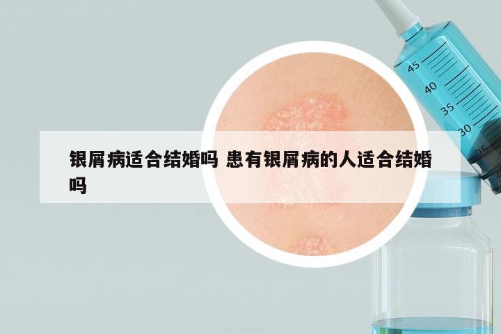 银屑病适合结婚吗 患有银屑病的人适合结婚吗