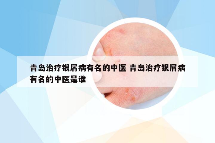 青岛治疗银屑病有名的中医 青岛治疗银屑病有名的中医是谁