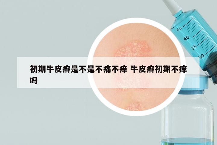 初期牛皮癣是不是不痛不痒 牛皮癣初期不痒吗