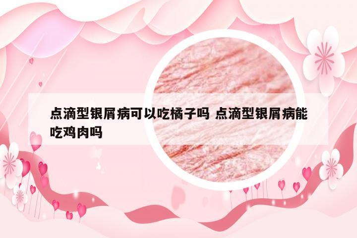 点滴型银屑病可以吃橘子吗 点滴型银屑病能吃鸡肉吗