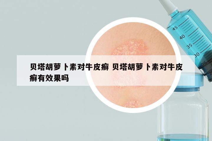贝塔胡萝卜素对牛皮癣 贝塔胡萝卜素对牛皮癣有效果吗