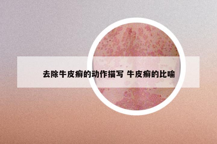去除牛皮癣的动作描写 牛皮癣的比喻