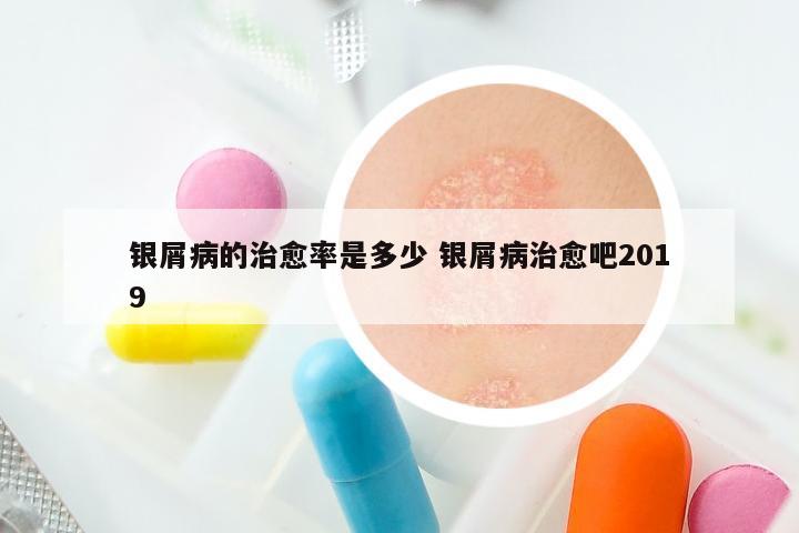 银屑病的治愈率是多少 银屑病治愈吧2019
