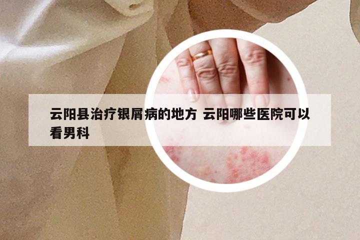 云阳县治疗银屑病的地方 云阳哪些医院可以看男科