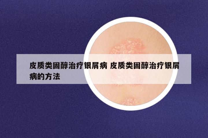 皮质类固醇治疗银屑病 皮质类固醇治疗银屑病的方法
