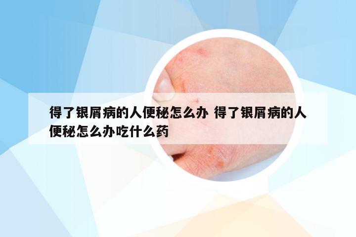得了银屑病的人便秘怎么办 得了银屑病的人便秘怎么办吃什么药