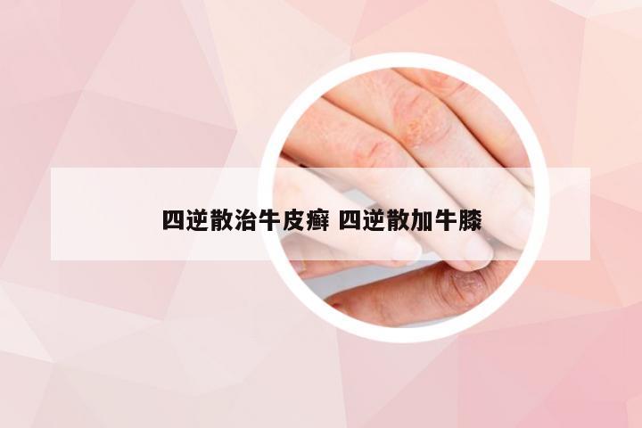 四逆散治牛皮癣 四逆散加牛膝