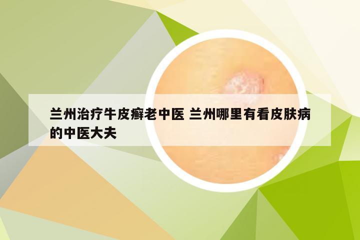兰州治疗牛皮癣老中医 兰州哪里有看皮肤病的中医大夫