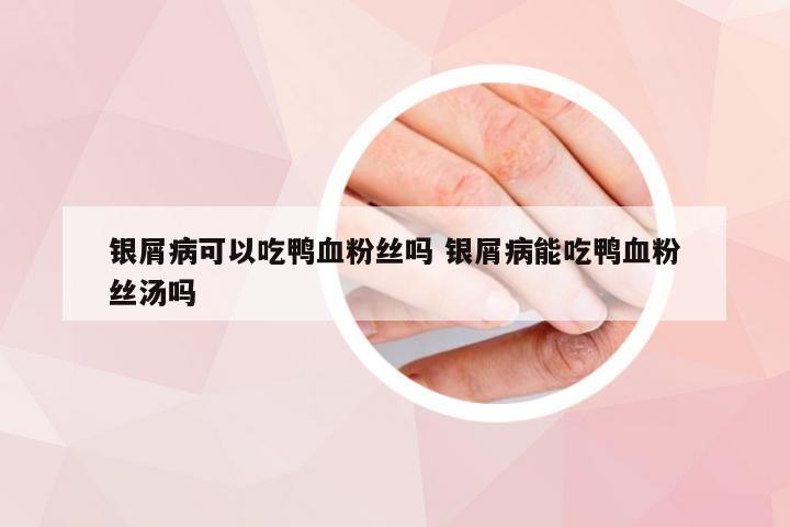 银屑病可以吃鸭血粉丝吗 银屑病能吃鸭血粉丝汤吗