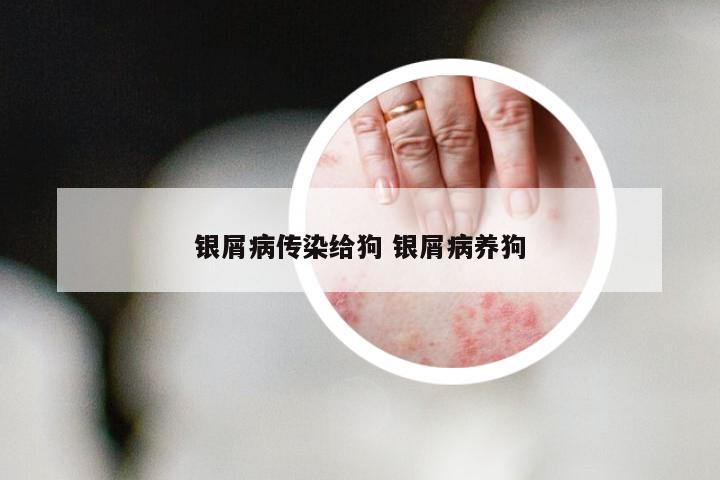 银屑病传染给狗 银屑病养狗