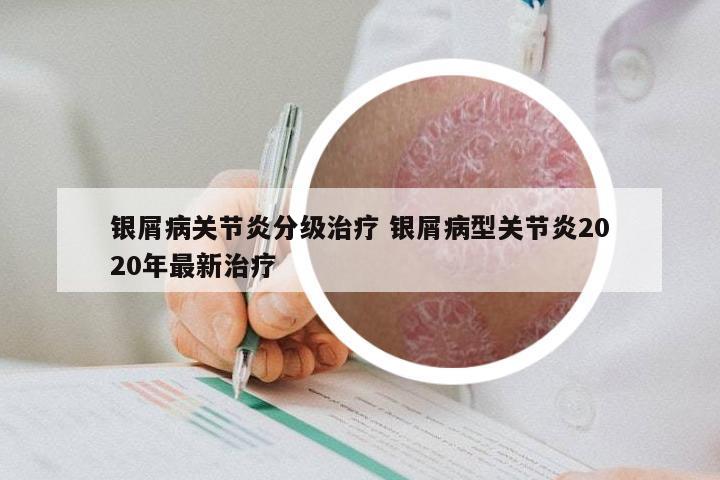 银屑病关节炎分级治疗 银屑病型关节炎2020年最新治疗