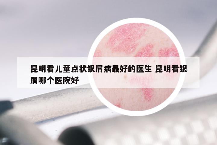 昆明看儿童点状银屑病最好的医生 昆明看银屑哪个医院好