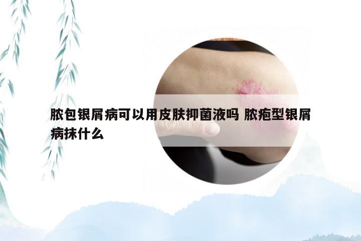 脓包银屑病可以用皮肤抑菌液吗 脓疱型银屑病抹什么