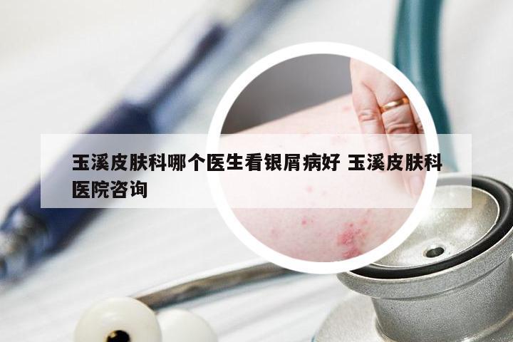 玉溪皮肤科哪个医生看银屑病好 玉溪皮肤科医院咨询
