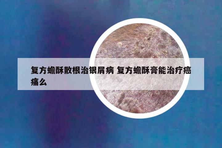 复方蟾酥散根治银屑病 复方蟾酥膏能治疗癌痛么