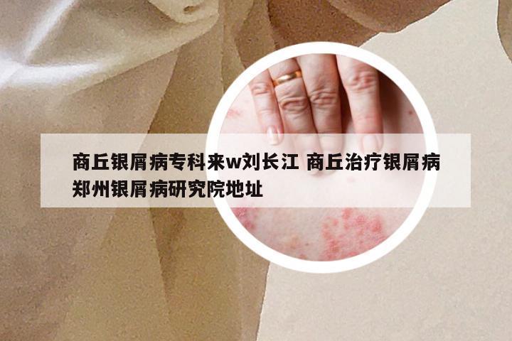 商丘银屑病专科来w刘长江 商丘治疗银屑病郑州银屑病研究院地址