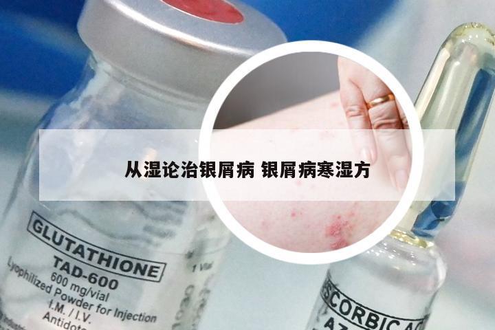 从湿论治银屑病 银屑病寒湿方