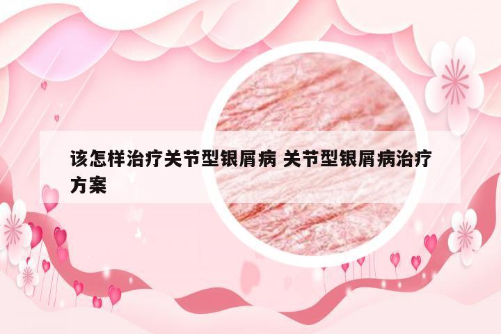 该怎样治疗关节型银屑病 关节型银屑病治疗方案