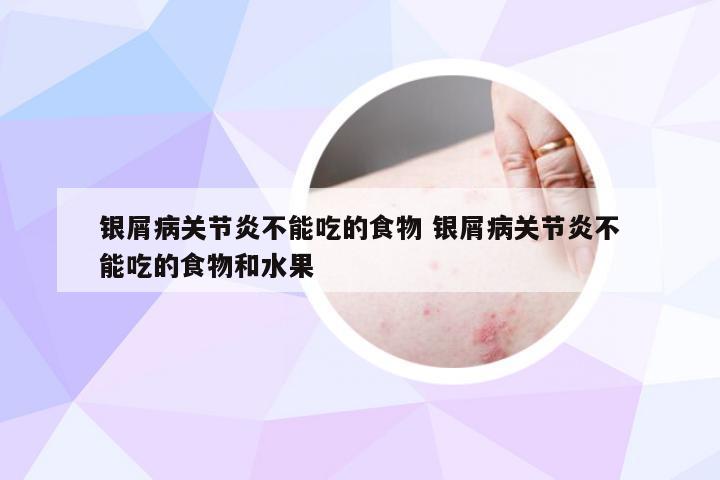 银屑病关节炎不能吃的食物 银屑病关节炎不能吃的食物和水果