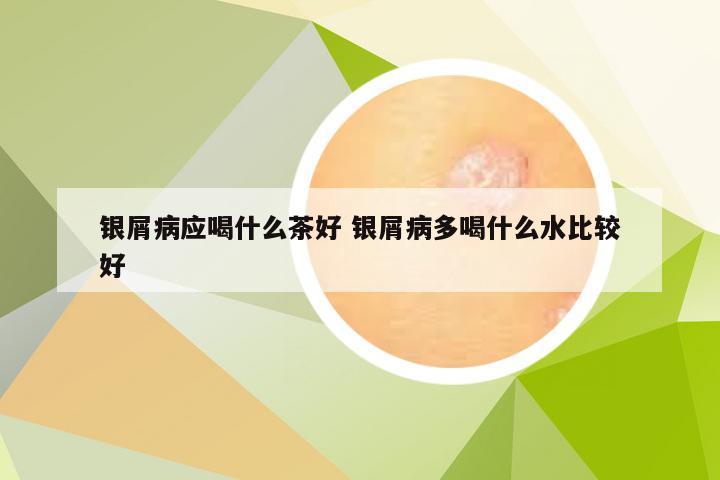 银屑病应喝什么茶好 银屑病多喝什么水比较好