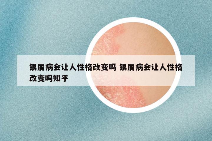 银屑病会让人性格改变吗 银屑病会让人性格改变吗知乎
