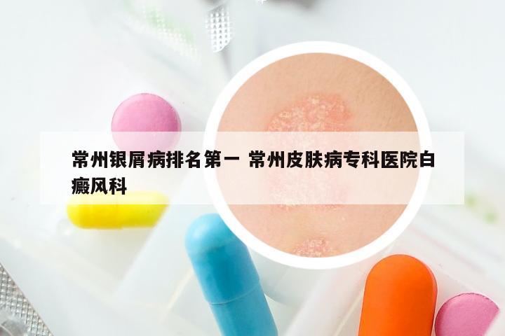 常州银屑病排名第一 常州皮肤病专科医院白癜风科