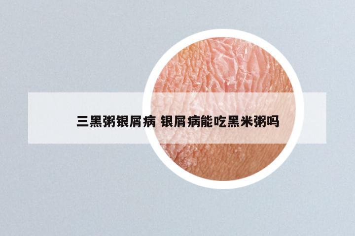 三黑粥银屑病 银屑病能吃黑米粥吗