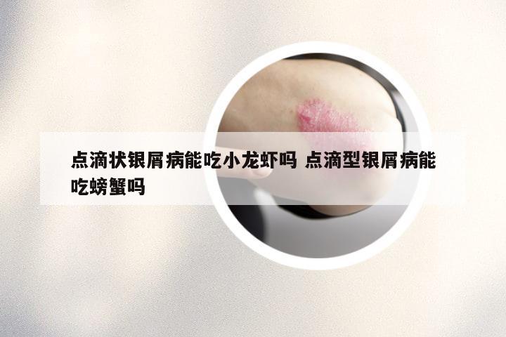 点滴状银屑病能吃小龙虾吗 点滴型银屑病能吃螃蟹吗