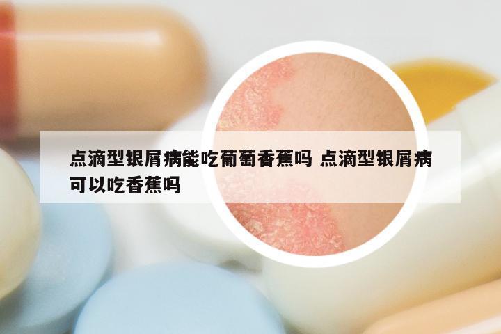 点滴型银屑病能吃葡萄香蕉吗 点滴型银屑病可以吃香蕉吗