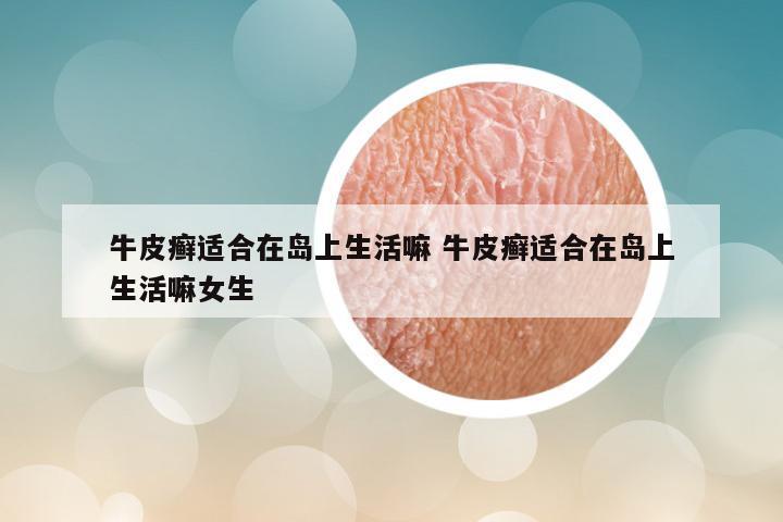 牛皮癣适合在岛上生活嘛 牛皮癣适合在岛上生活嘛女生