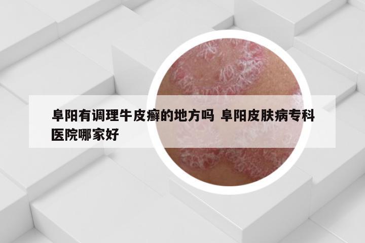 阜阳有调理牛皮癣的地方吗 阜阳皮肤病专科医院哪家好