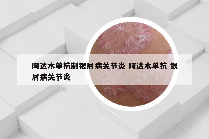 阿达木单抗制银屑病关节炎 阿达木单抗 银屑病关节炎