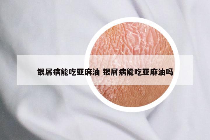 银屑病能吃亚麻油 银屑病能吃亚麻油吗
