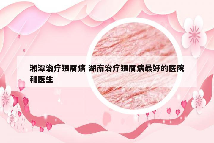 湘潭治疗银屑病 湖南治疗银屑病最好的医院和医生