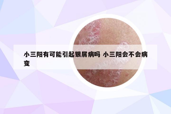 小三阳有可能引起银屑病吗 小三阳会不会病变