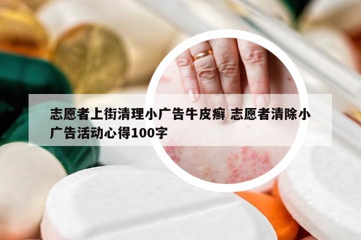 志愿者上街清理小广告牛皮癣 志愿者清除小广告活动心得100字