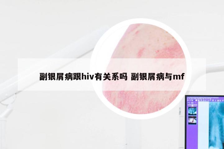 副银屑病跟hiv有关系吗 副银屑病与mf