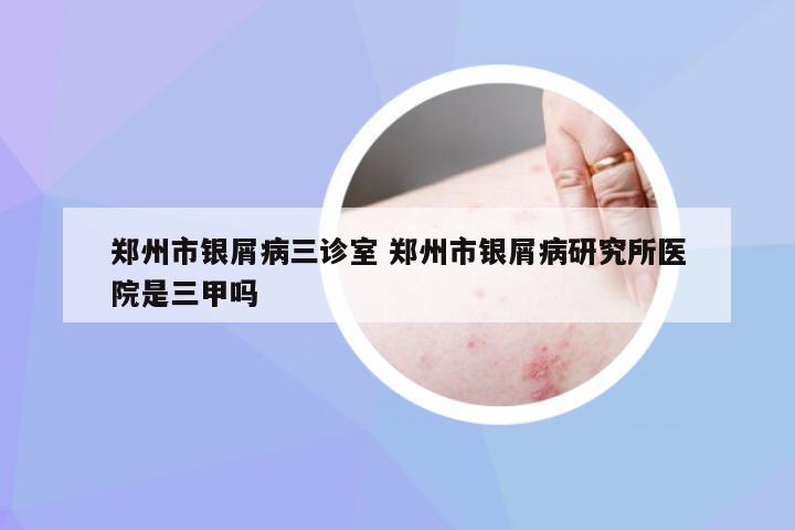 郑州市银屑病三诊室 郑州市银屑病研究所医院是三甲吗