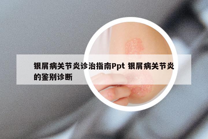 银屑病关节炎诊治指南Ppt 银屑病关节炎的鉴别诊断