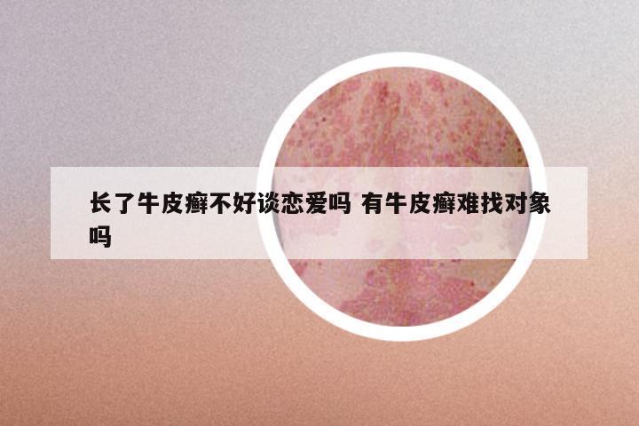 长了牛皮癣不好谈恋爱吗 有牛皮癣难找对象吗