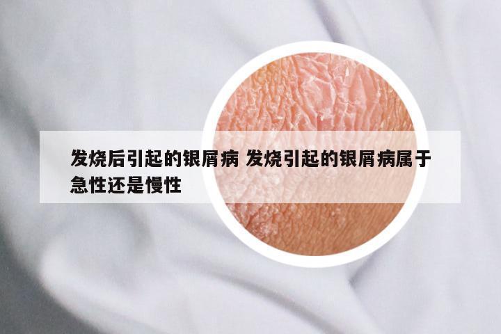 发烧后引起的银屑病 发烧引起的银屑病属于急性还是慢性