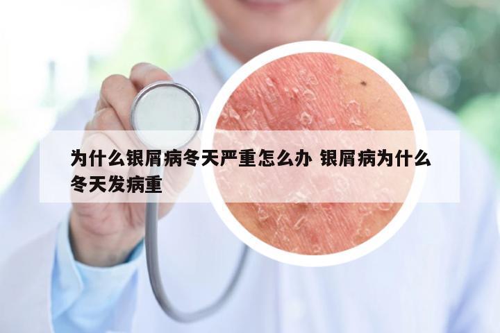 为什么银屑病冬天严重怎么办 银屑病为什么冬天发病重